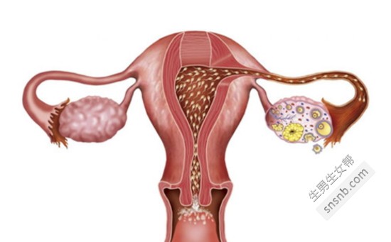 预防排卵障碍 不孕症(图1)